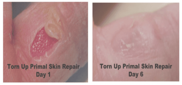 Skin Repair for Cuts, Cold Sores, Bites, and Lacerations - Image 5